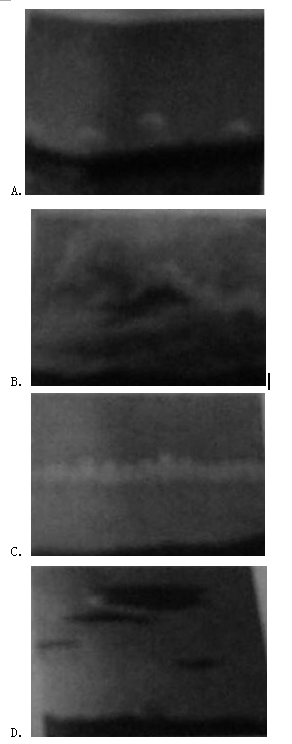2017下半年幼儿园教师资格《综合素质》考试